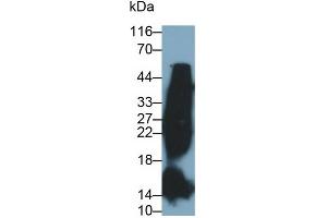 Detection of HbA1c in Human Blood Cells lysate using Monoclonal Antibody to Glycated Hemoglobin A1c (HbA1c) (HbA1c anticorps)