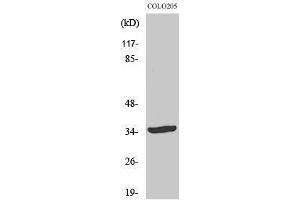 Western Blotting (WB) image for anti-Ubiquitin Thioesterase OTU1 (YOD1) (Internal Region) antibody (ABIN3186223) (YOD1 anticorps  (Internal Region))