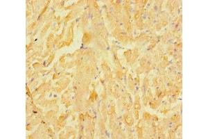 Immunohistochemistry of paraffin-embedded human heart tissue using ABIN7158138 at dilution of 1:100 (LRRC15 anticorps  (AA 301-538))
