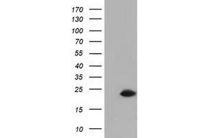 Western Blotting (WB) image for anti-Retinoblastoma Binding Protein 9 (RBBP9) antibody (ABIN1500627)