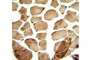 IHC analysis of FFPE human skeletal muscle stained with ULK1 antibody