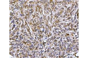 IHC analysis of Nesprin 2/SYNE2 using anti-Nesprin 2/SYNE2 antibody (ABIN7601532).