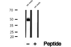 Western blot analysis of extracts of rat testis tissue, using DYX1C1 antibody. (DYX1C1 anticorps)