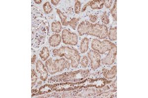 Immunohistochemical analysis of ABIN6242882 on paraffin-embedded Human kidney tissue.