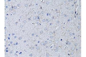 Immunohistochemistry of paraffin-embedded rat brain using RYR2 Antibody (ABIN5970123) at dilution of 1/100 (40x lens). (RYR2 anticorps)