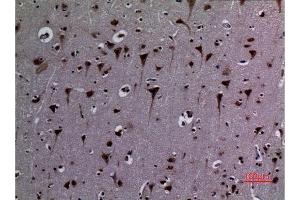 Immunohistochemistry (IHC) analysis of paraffin-embedded Human Brain, antibody was diluted at 1:100.