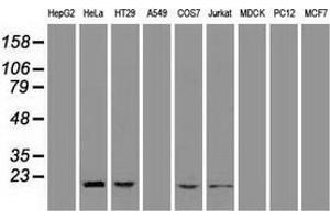Western blot analysis of extracts (35 µg) from 9 different cell lines by using anti-AK1 monoclonal antibody. (Adenylate Kinase 1 anticorps)