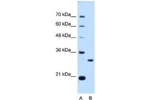 PSME3 antibody used at 0. (PSME3 anticorps  (N-Term))