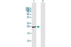 Western Blot analysis of MYL7 expression in transfected 293T cell line by MYL7 MaxPab polyclonal antibody. (MYL7 anticorps  (AA 1-175))