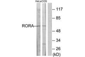 Western blot analysis of extracts from HeLa/COS7 cells, using RORA Antibody. (RORA anticorps  (AA 6-55))