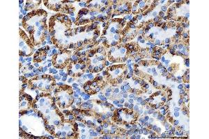 IHC analysis of ATP1B1 using anti-ATP1B1 antibody (ABIN7602014).