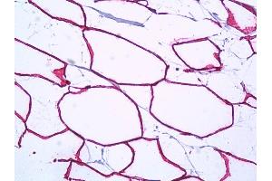 Anti-PTRF antibody IHC of human breast, adipocytes.