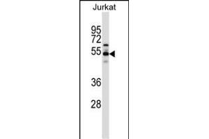VPS4B Antibody (C-term) (ABIN657734 and ABIN2846719) western blot analysis in Jurkat cell line lysates (35 μg/lane). (VPS4B anticorps  (C-Term))