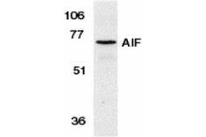 Western blot analysis of AIF in K562 cell lysate with AP30029PU-N AIF antibody at 1 μg/ml. (AIF anticorps  (N-Term))