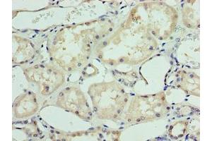 Immunohistochemistry of paraffin-embedded human kidney tissue using ABIN7144972 at dilution of 1:100 (DHX9 anticorps  (AA 325-840))