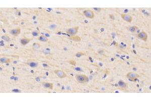 Detection of MAP2 in Human Cerebrum Tissue using Polyclonal Antibody to Microtubule Associated Protein 2 (MAP2) (MAP2 anticorps  (AA 727-985))