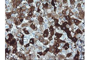anti-Deleted in Primary Ciliary Dyskinesia Homolog (DPCD) antibody