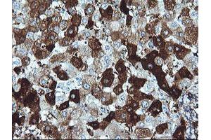 Image no. 1 for anti-Deleted in Primary Ciliary Dyskinesia Homolog (DPCD) antibody (ABIN1497889) (DPCD anticorps)