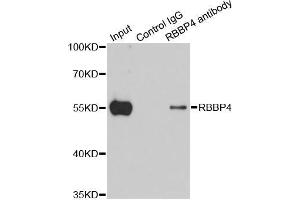 Immunoprecipitation analysis of 200 μg extracts of 293T cells using 1 μg RBBP4 antibody (ABIN5970697).