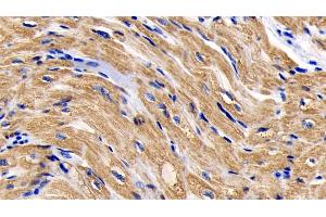Detection of CYCS in Human Cardiac Muscle Tissue using Monoclonal Antibody to Cytochrome C (CYCS) (Cytochrome C anticorps  (AA 5-100))