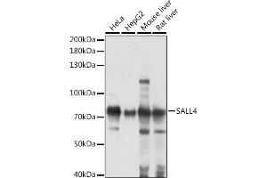 Western blot analysis of extracts of various cell lines, using S antibody (ABIN7270138) at 1:1000 dilution. (SALL4 anticorps  (AA 853-1053))