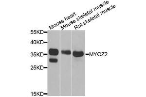 Western blot analysis of extracts of various cell lines, using MYOZ2 antibody. (MYOZ2 anticorps)
