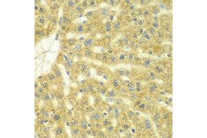Immunohistochemistry of paraffin-embedded rat liver using ADCK3 antibody at dilution of 1:100 (x40 lens). (COQ8A anticorps)