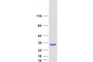 Validation with Western Blot