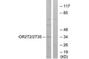 Western blot analysis of extracts from HepG2 cells, using OR2T2/2T35 Antibody. (OR2T2/2T35 anticorps  (AA 61-110))