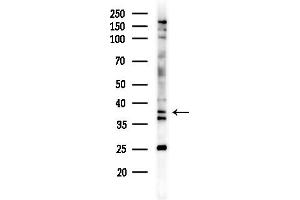 Western blot analysis of lysates from MCF7 cells(heat-shock,45 min treatment), using ASBT Antibody at 1/1000 dilution.