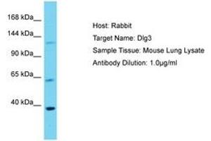 Image no. 1 for anti-Discs, Large Homolog 3 (DLG3) (AA 201-250) antibody (ABIN6750501) (DLG3 anticorps  (AA 201-250))