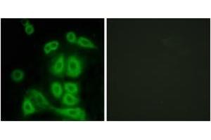 Immunofluorescence analysis of A549 cells, using FXR2 Antibody.