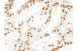 Immunohistochemistry (IHC) image for anti-KH-Type Splicing Regulatory Protein (KHSRP) (AA 100-150) antibody (ABIN7448625)