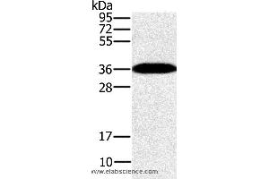 Western blot analysis of Mouse brain tissue, using PPP1CC Polyclonal Antibody at dilution of 1:200