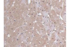 DAB staining on IHC-P; Samples: Rat Heart Tissue (Ninein anticorps  (AA 1-153))