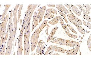 Detection of RSPO1 in Mouse Cardiac Muscle Tissue using Polyclonal Antibody to R-Spondin 1 (RSPO1)