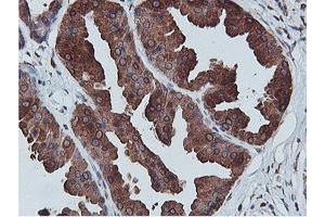 Immunohistochemical staining of paraffin-embedded Human breast tissue using anti-C20orf3 mouse monoclonal antibody. (APMAP anticorps)