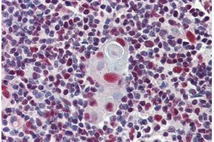 Human Thymus: Formalin-Fixed, Paraffin-Embedded (FFPE)