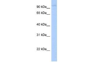 LRRC8A antibody used at 1 ug/ml to detect target protein. (LRRC8A anticorps  (N-Term))