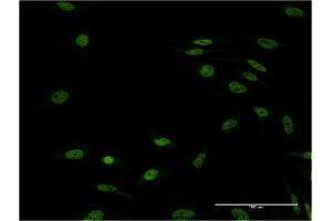 Immunofluorescence of monoclonal antibody to FOXL1 on HeLa cell.