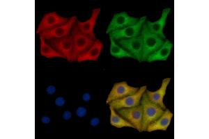 P2X7 Mouse Monoclonal Antibody staining Hela cells by IF/ICC.