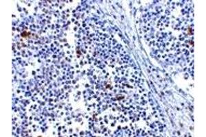 Immunohistochemistry (IHC) image for anti-Interferon Induced with Helicase C Domain 1 (IFIH1) (Middle Region) antibody (ABIN1031000) (IFIH1 anticorps  (Middle Region))