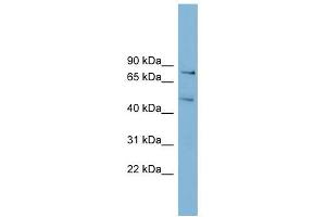 BOP1 antibody used at 1 ug/ml to detect target protein. (BOP1 anticorps  (N-Term))