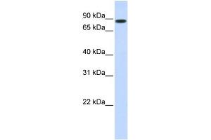 WB Suggested Anti-STAT5B Antibody Titration: 1 ug/ml Positive Control: 293T cells lysate There is BioGPS gene expression data showing that STAT5B is expressed in HEK293T