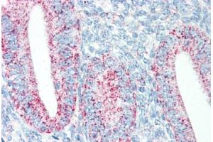 Human Uterus (formalin-fixed, paraffin-embedded) stained with HSPD1 antibody ABIN334251 at 5 ug/ml followed by biotinylated anti-mouse IgG secondary antibody ABIN481714, alkaline phosphatase-streptavidin and chromogen.