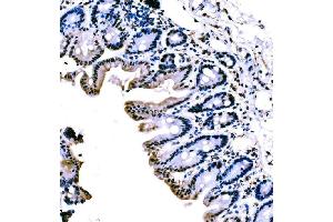 IHC analysis of KLF4 using anti-KLF4 antibody (ABIN7599343). (KLF4 anticorps  (AA 1-389))