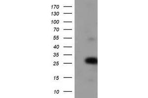 Western Blotting (WB) image for anti-Zinc Finger, AN1-Type Domain 2B (ZFAND2B) antibody (ABIN1501809) (ZFAND2B anticorps)