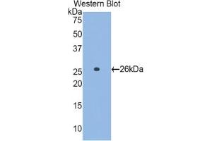 Western blot analysis of the recombinant protein. (GCLC anticorps  (AA 429-637))