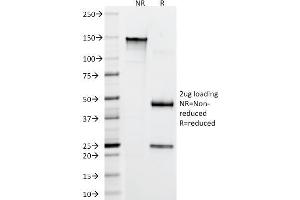 SDS-PAGE Analysis Purified CD22 Mouse Monoclonal Antibody (FR10B4). (CD22 anticorps)