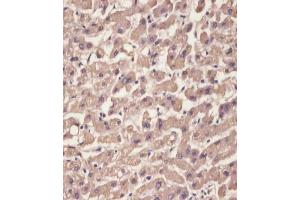 (ABIN652227 and ABIN2840949) staining TTR in human liver tissue sections by Immunohistochemistry (IHC-P - paraformaldehyde-fixed, paraffin-embedded sections).